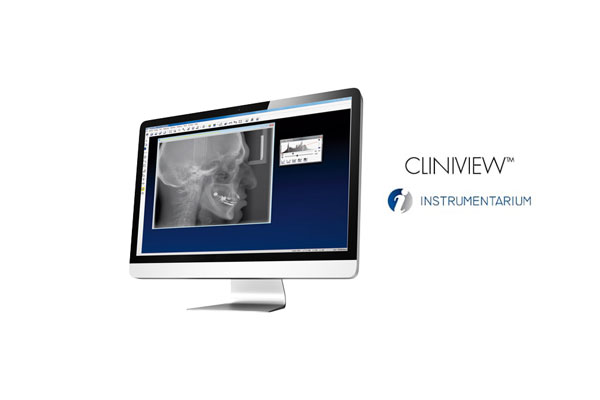 Cliniview - DiagnoDent